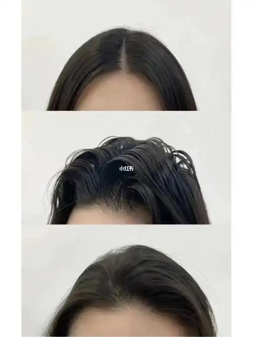 头发贴头皮757575757575