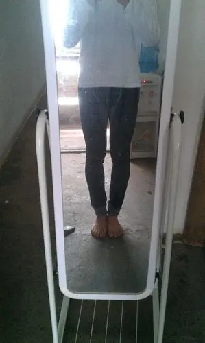 轻度o型腿.现在轻度o型腿很好矫正的. 追问 怎麼矫正呢?