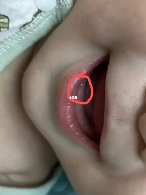 婴儿长牙  #宝宝出牙 #出牙期的宝宝症状今天小牙已经冒尖尖了出牙时