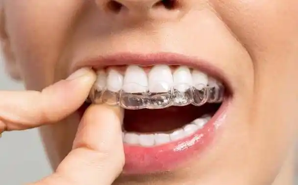 清洗五到十分钟,或拿一只硬毛牙刷来刷净牙套里外