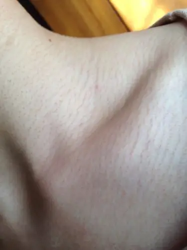 脖子上长满了像是这样的小嘎的 不疼也不痒 是怎么回事