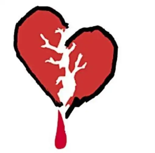 心疼是什么感觉你体验过心痛的感觉吗