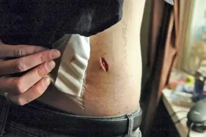 突然扭身,可能会导致背阔肌拉伤,背阔肌在脊柱两侧,背部偏下的位置