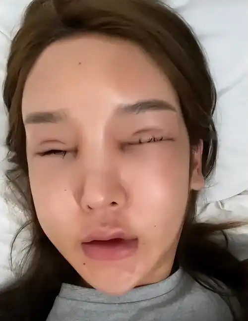 如今经过数次整容失败,桃花宝宝也开始清醒整容有风险,大家不要贸然