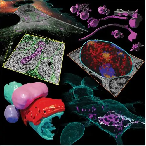 correlative three-dimensional super-resolution and block-face