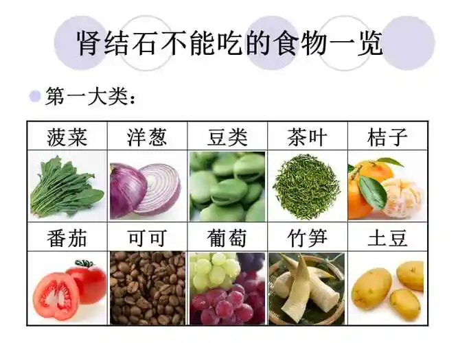 肾结石不能吃什么ppt