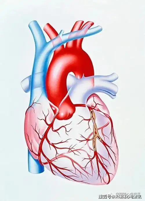 为心脏供血的管路冠状动脉