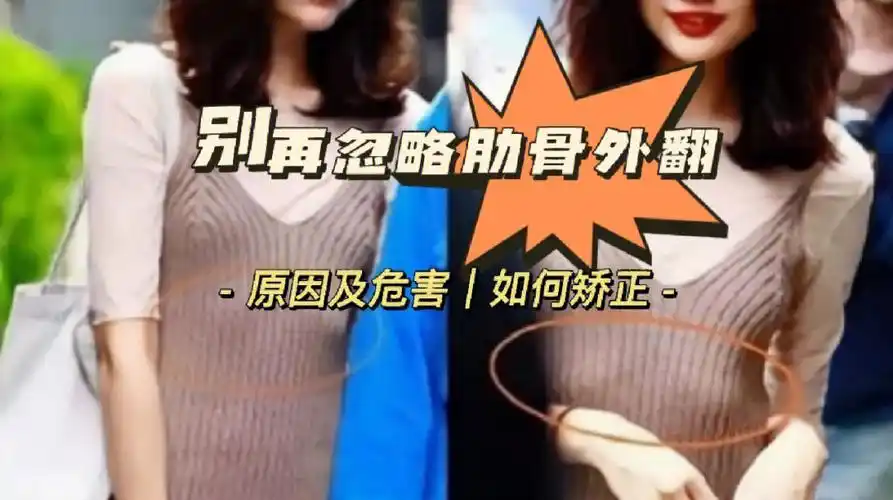 别再忽略肋骨外翻75矫正就现在