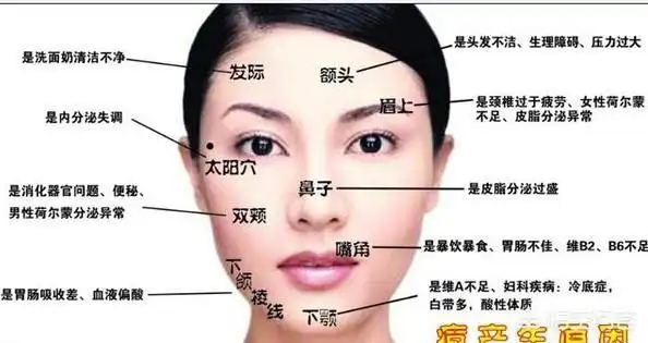 眉心和鼻翼两侧长痘痘是什么原因造成的_清洁门户