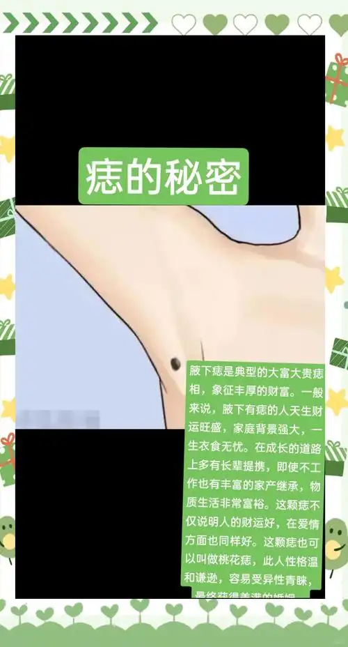 腋下痣:财富与爱情的双重福星