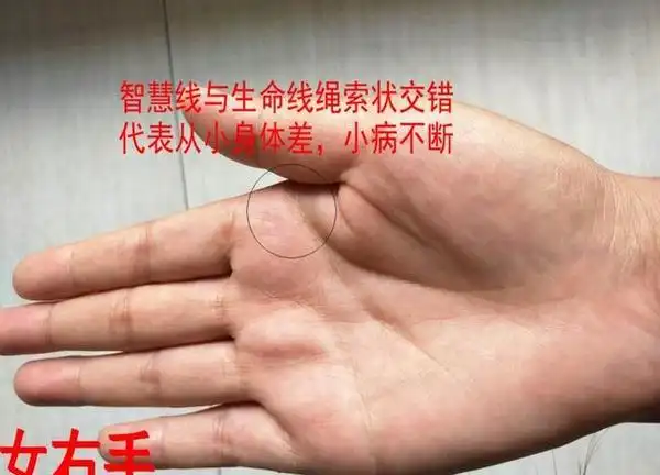 第三,生命线与智慧线绳索状相交延伸,身体从小小病不断.