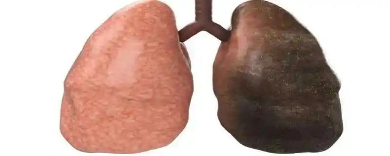 假如你吸烟,要想清洁肺部,戒烟是最重要的步骤.