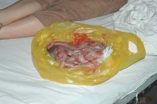 女孩怀孕婴儿被杀(歌手魔羯日记147)