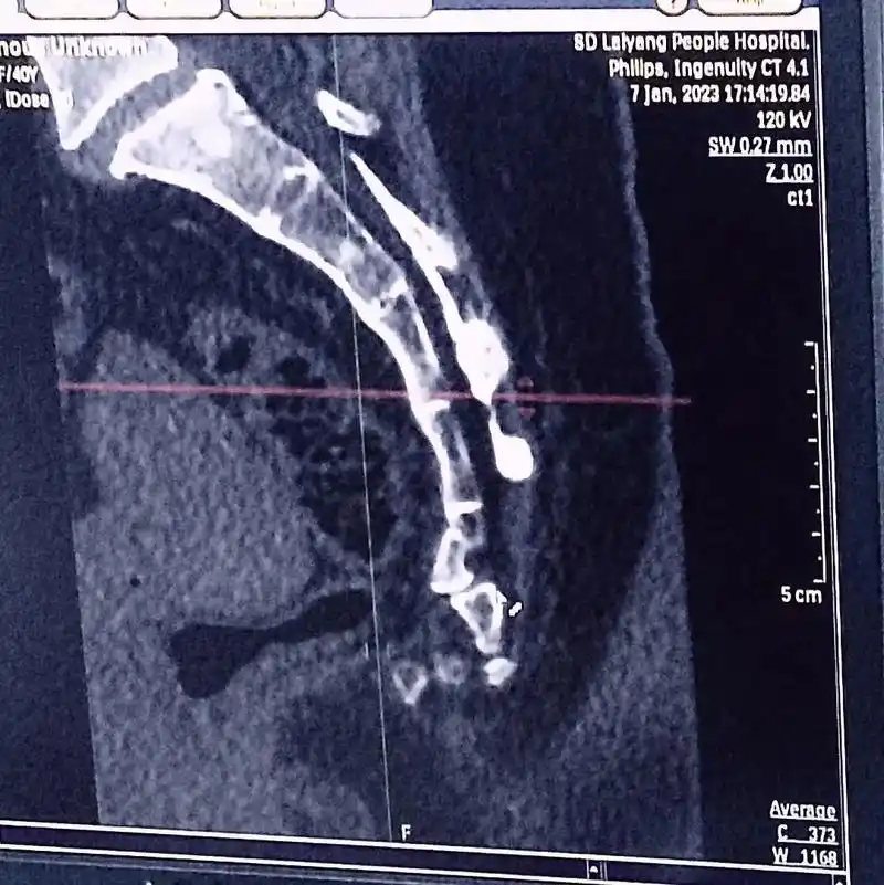 今天太多朋友私信我到底是什么情况,是我很不中用的