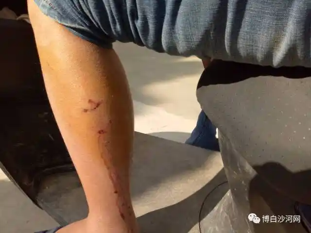 早上约9时,这条疯狗突然冲进沙菱公路边的羊角岭队,见人咬人,见鸡咬鸡