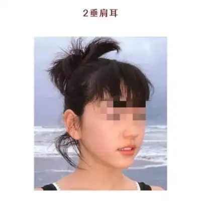 4种耳朵,看你一生福气有多厚!