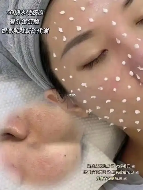 日本bota海绵骨针搭配精华效果事半功倍