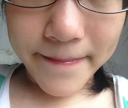 请问有什么方法可以让鼻头