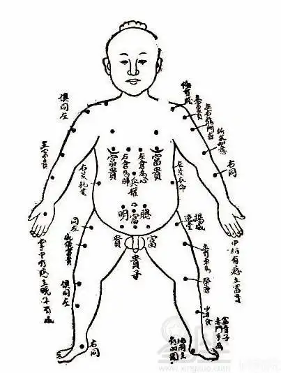 痣相图解大全痣的位置与命运