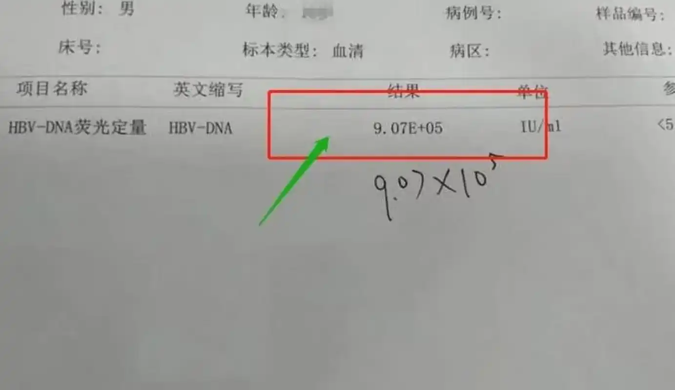 乙肝病毒的dna定量检测,是用来检测患者血清当中乙肝病毒的含量佑