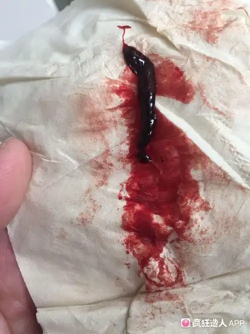 月经血中黑色的是什么