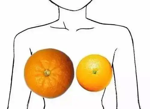 胸一大一小怎么调整过来大小胸做假体隆胸可以改善吗