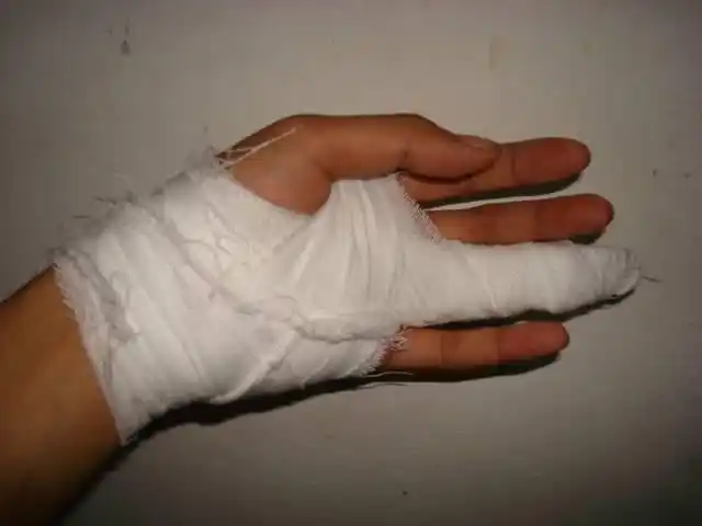 我手指受伤了,筋断了,打不了球了,大家保重哦!(康复咯 幸运啊)