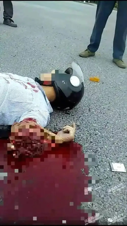 西塘桥发生惨烈车祸摩托车驾驶员手臂被折断皮开肉绽