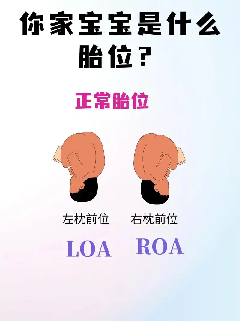 宝宝胎位#孕妈 #产检 #一路绿灯迎接小生命 - 抖音