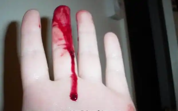 梦见手受伤流血是什么预兆(不同人流血解梦)-风水人