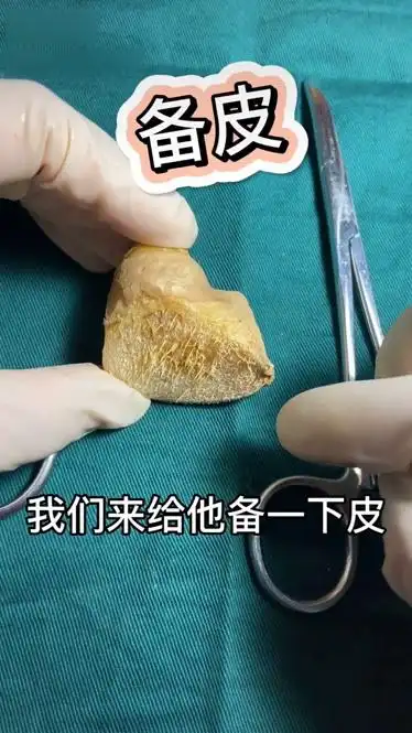 术前准备简称备皮