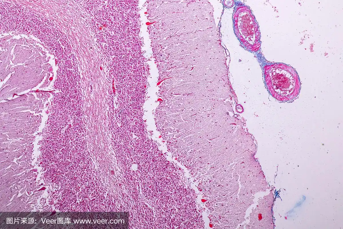 实验用显微镜下小脑和神经人体横切面.
