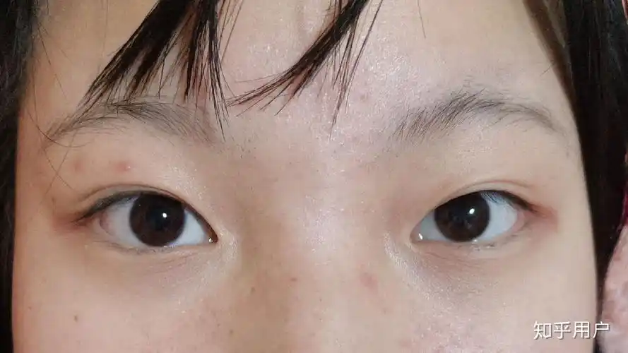 眼距宽是种什么体验? - 知乎