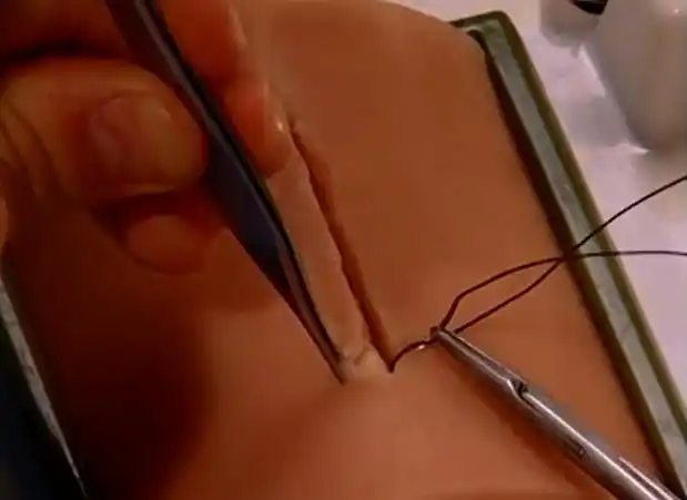 谁说剖腹产不痛?剖完后的8个小时痛得想打滚!