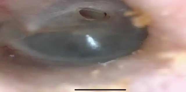 人需要掏耳屎吗?敲黑板划重点