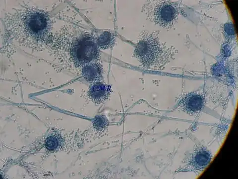 分享我分离的曲霉菌