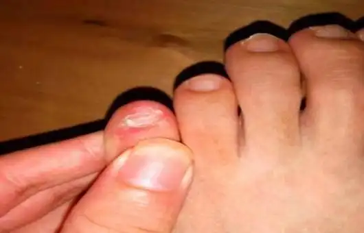 如果你的小脚趾有两瓣趾甲,或许不是纯正汉人,而是他们的后代