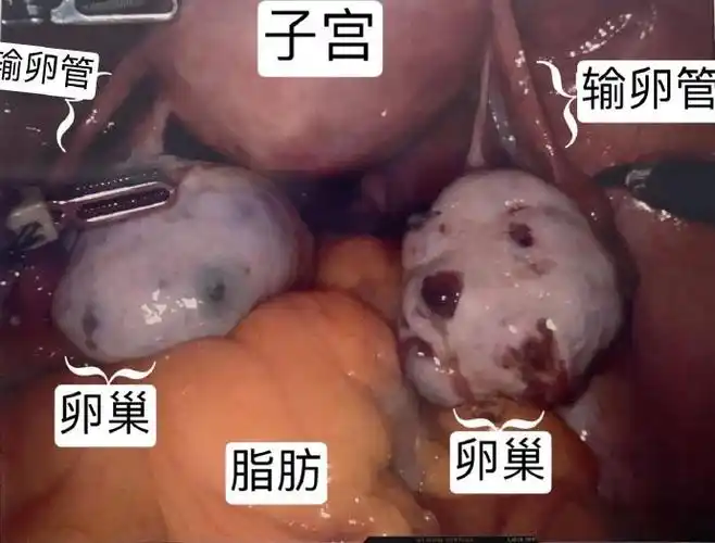 阴蒂避孕##性义务##阴蒂避孕