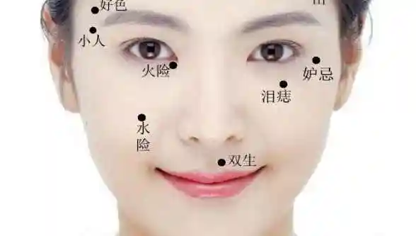 这4个部位长"痣",一生财运相随事业有成