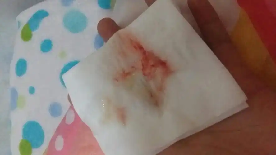 咳血痰,鲜红色.想问问可能是什么病症.