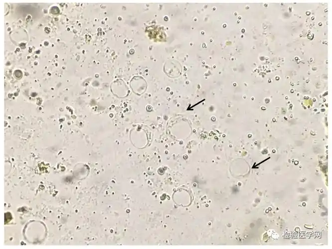人芽囊原虫你了解多少?