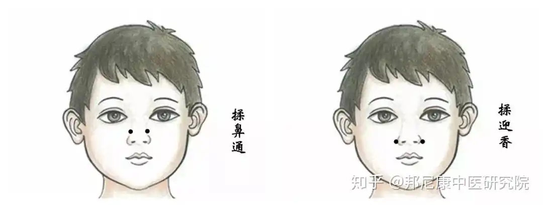 孩子鼻甲肥大,腺样体肥大,上颌窦炎全都有! - 知乎