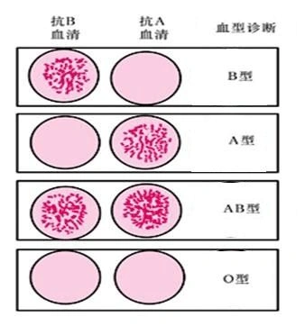 实验一 血型鉴定与交叉配血-修改后
