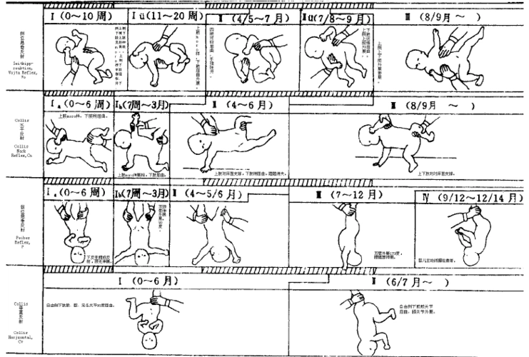 vojta姿势反射图示