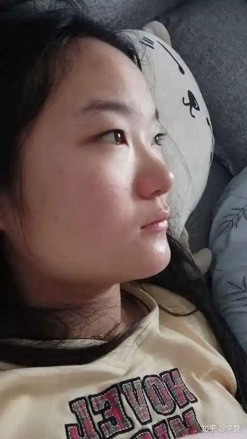 鼻子塌的女孩怎样由丑变美?