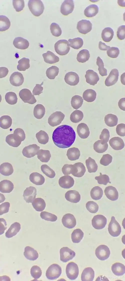 血细胞形态学之原始细胞