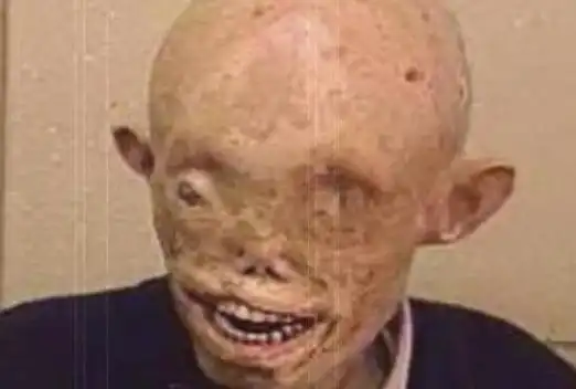 日本核辐射下的变异人