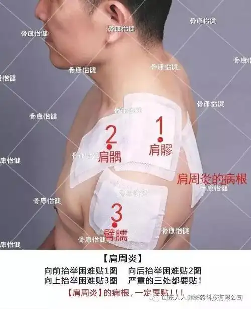 肩周炎的贴敷方法:    肩周炎必须要贴敷病根:天宗穴    肩膀向上举