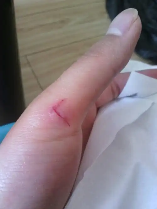 昨晚手被玻璃划伤了伤口不大,有点深,出了蛮多血的,已经自己敷上云南