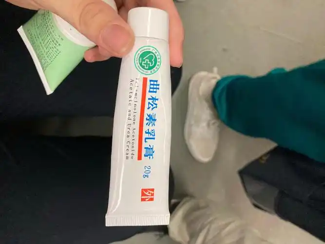 手部湿疹能根治吗